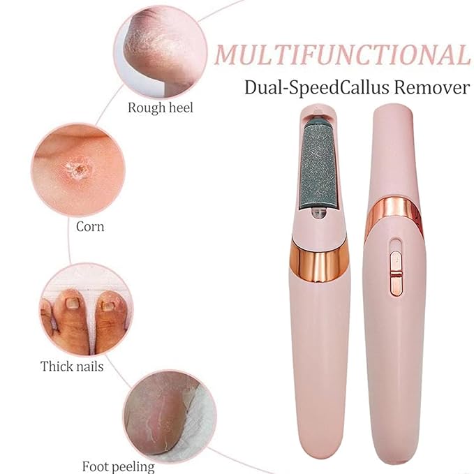 Rechargeable Callus Remover