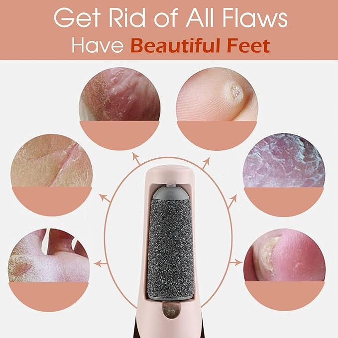 Rechargeable Callus Remover